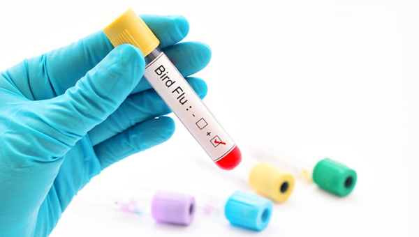 Avian İnfluenza (Kuş Gribi)